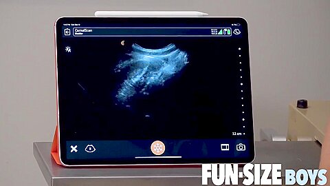 Doctor Suggests Hung Nurse Raw Fuck Boy With Ultrasound